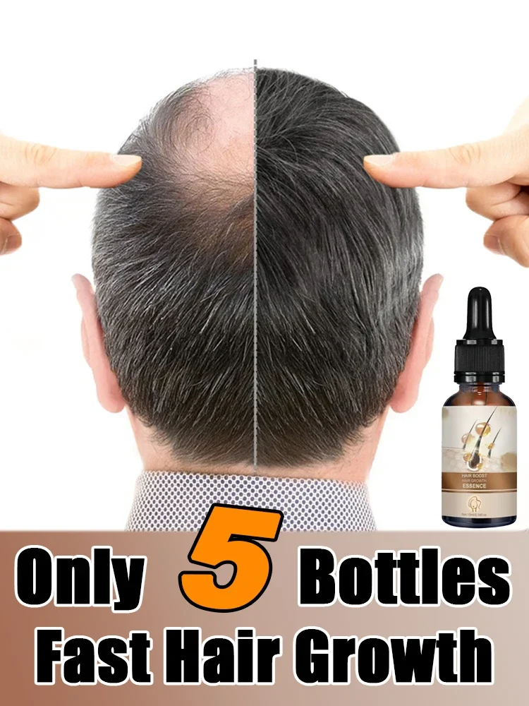 

Effective Fast Hair Growth Baldness Repair Hereditary Hair Loss Postpartum Hair Seborrheic 7 days