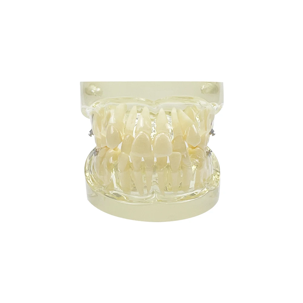 Orthodontic Treatment Teeth Model Resin Study Model Malocclusion Correction Typodont Model For Studying Dentist Communication