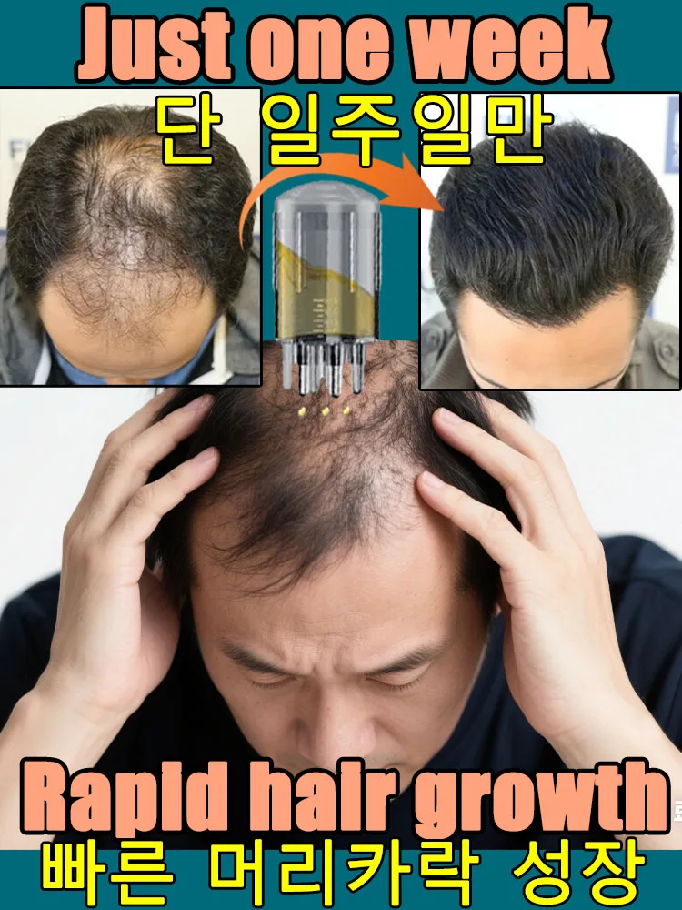 

100% revive hair, strong penetration, activate hair roots, more hair, say goodbye to baldness, thick hair