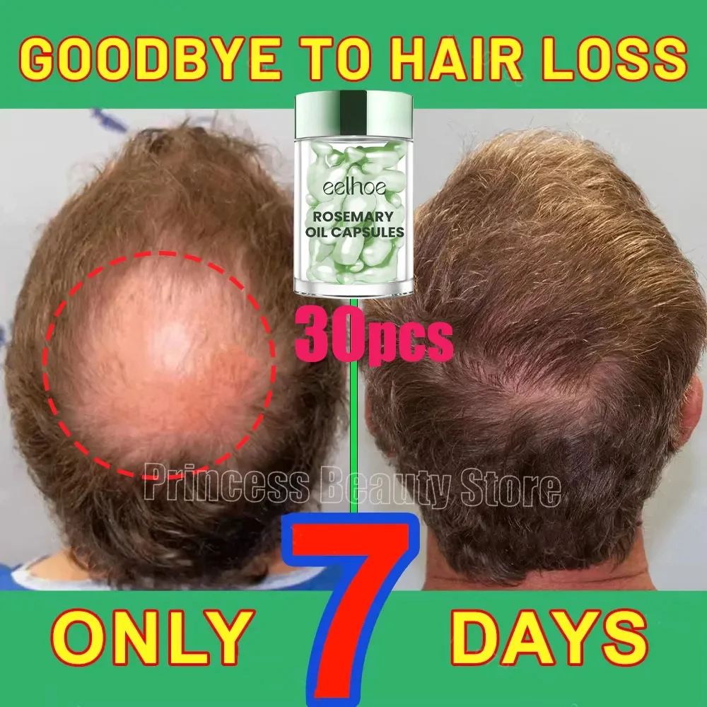 

Hair Growth Products Anti Hair Loss Essential Oil Prevent Baldness Scalp Treatment Capsule Fast Regrowth Beauty Health Men Women