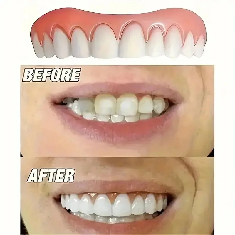 جديد طقم أسنان من السيليكون طقم أسنان سيليكون بطانات طقم أسنان ناعم طقم أسنان ناعم الأسنان العلوي والسفلي مجموعة سهلة الاستخدام الأقواس #5