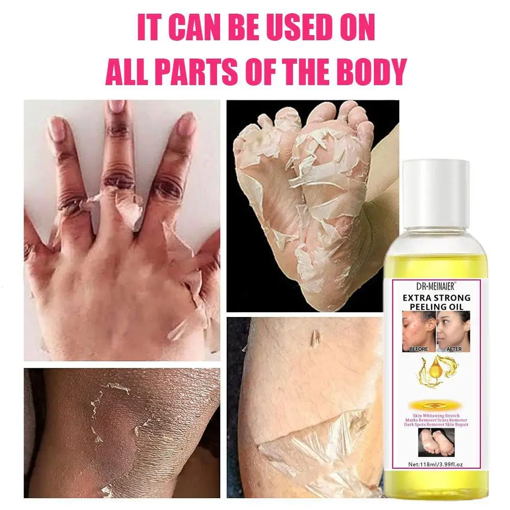 Soften Body Peel Off Dead Skin - High Power Yellow Peeling Oil For Hand, Feet, Leg Moisturizing Exfoliator Skin Care Product