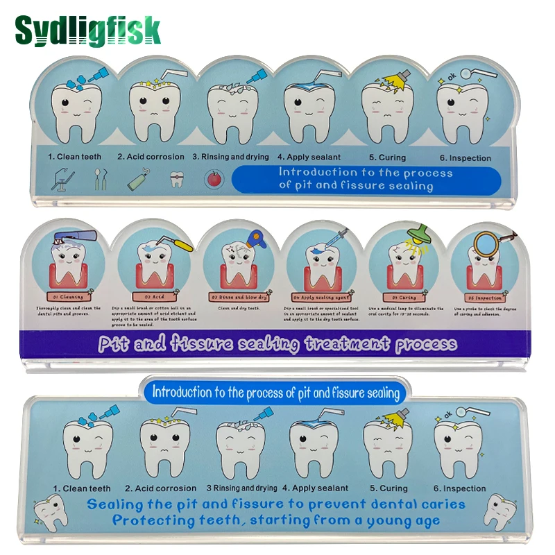 

Dental Model Tooth Pathological Teaching Model Pit And Fissure Sealing Treatment Model Doctor-Patient Communication Dentist Gift