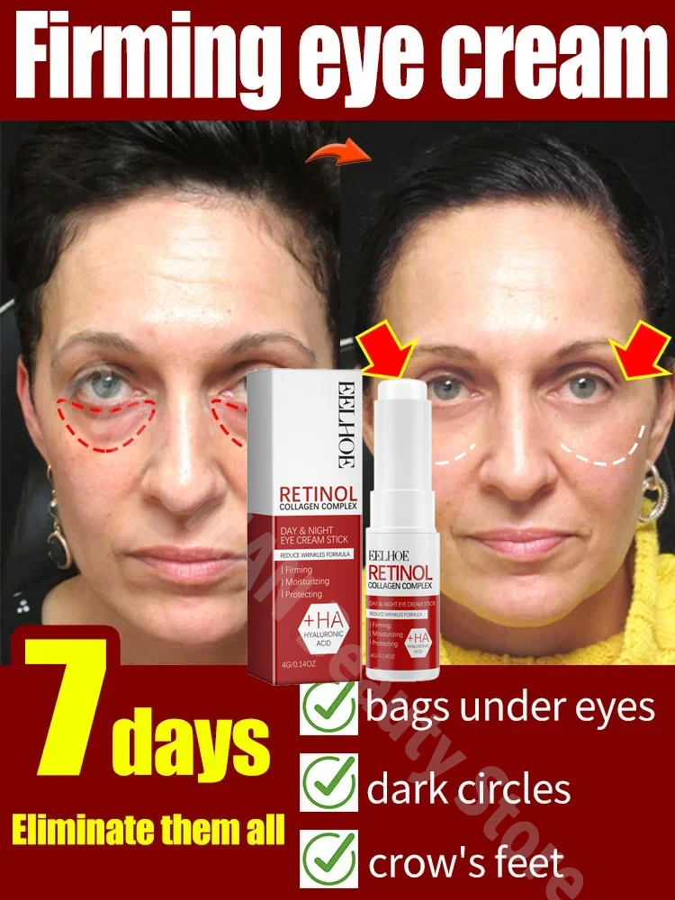 

Retinol Eye Cream Lighten Dark Circles Firm Anti-Puffiness Skin Instant Remove Wrinkles Eye Repair Serum Stick for women Women