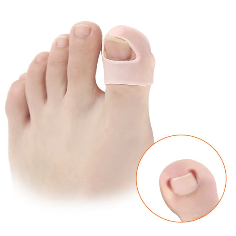 

3Pairs Gel Silicone Ingrown Toenail Correction Invisible Ingrown Toe Nail Straightening Clip Brace Treatment Foot Care Tools