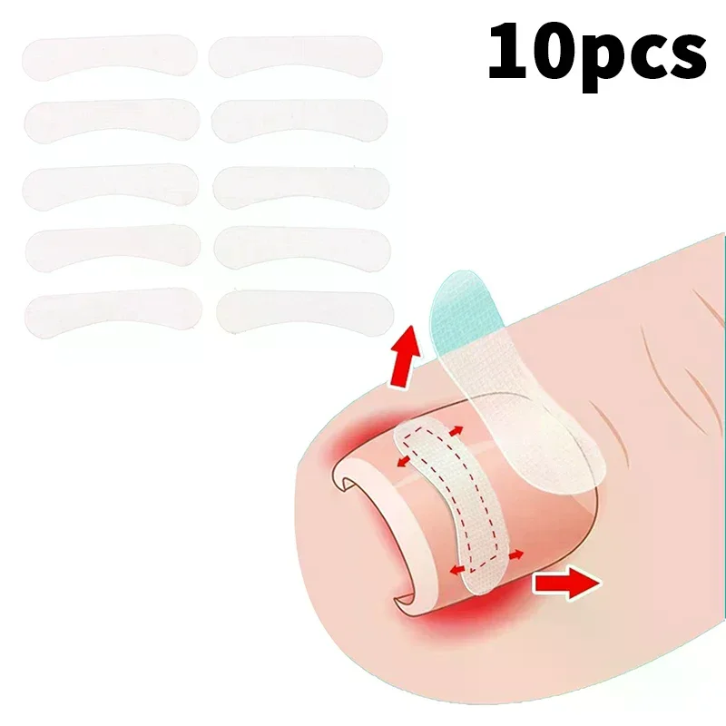 10Pcs Ingrown Toenail Correction Tool Straightening Clip Brace Ingrown Toe Nail Treatment Elastic Patch Sticker Pedicure Tool