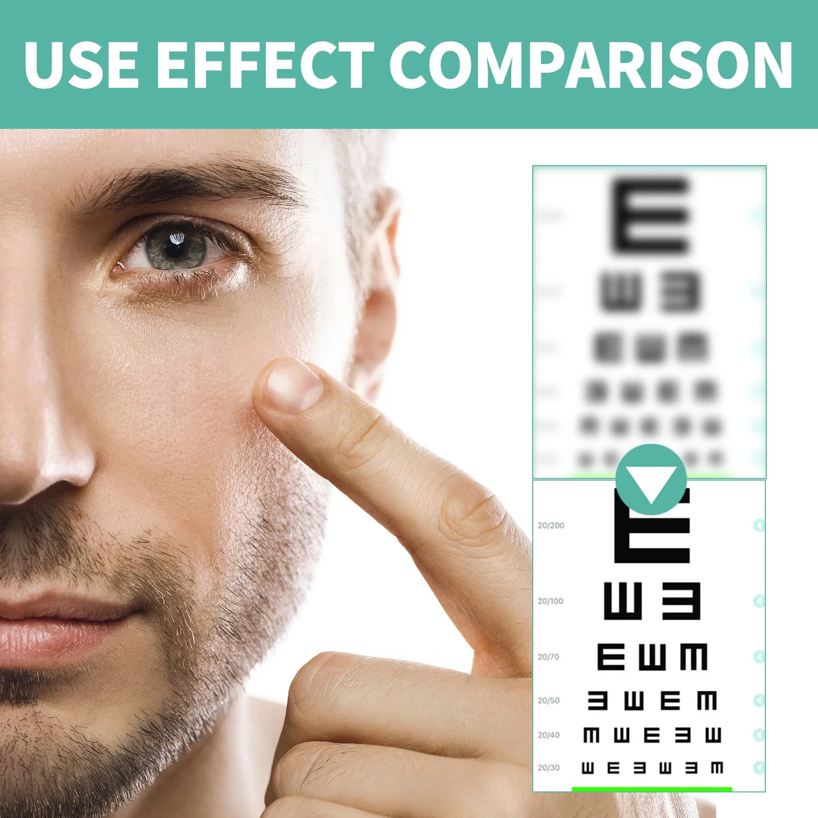 Eye Edema Relieve Vision Myopia Treatment Eye Care Patch Fatigue Vision Enhance Roller Improve Eye Relieve Focus On Eye Health