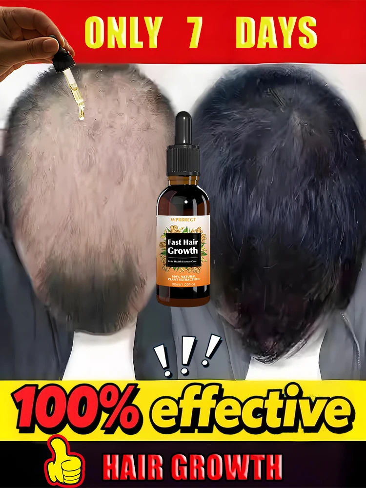 

Lᴏsɪɴɢ ʜᴀɪʀ Tʜɪs ɴᴇᴡ ʜᴀɪʀ ɢʀᴏᴡᴛʜ sᴇʀᴜᴍ ᴄᴀɴ ᴍᴀᴋᴇ ʏᴏᴜʀ ʜᴀɪʀ ᴛʜɪᴄᴋᴇʀ