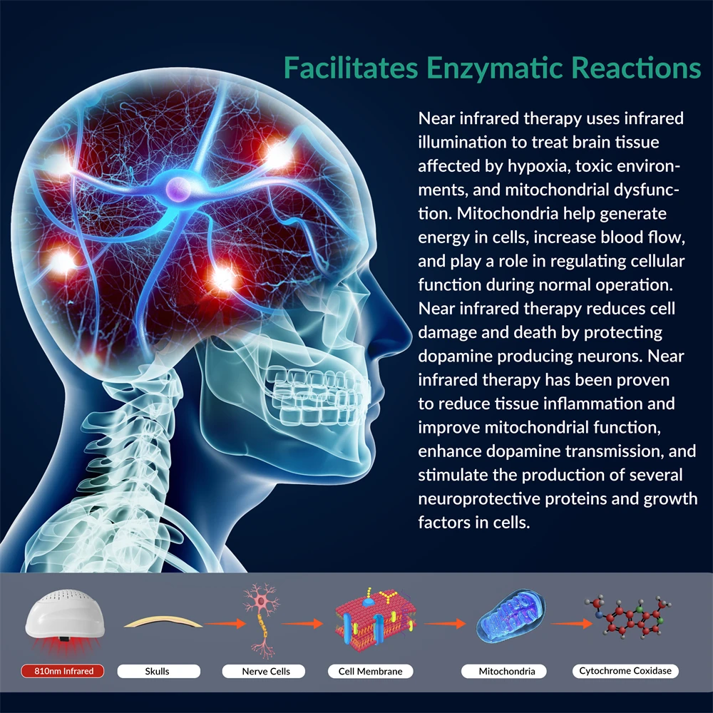 ZJKC Alzheimer Helmet 810nm Stroke Recovery Tools Parkinson Remedy Improve the Metabolic Ability of Neurons Enhance Cognition