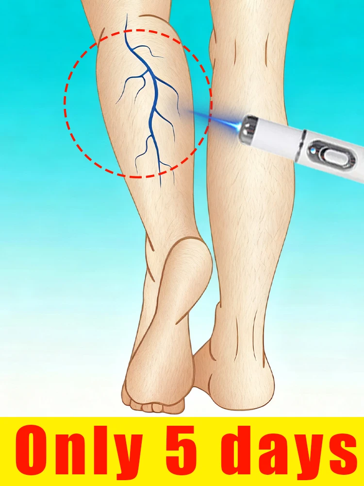 

Protect your leg's vitality, starting with focusing on venous health.