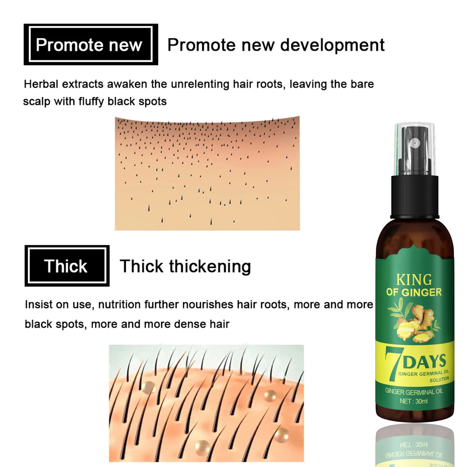 Hair Growth Serum Fast Growing Hair Essential Oil Beauty Hair Care 30/50ml Dense Regrowth Ginger Hair Promoting Regeneration