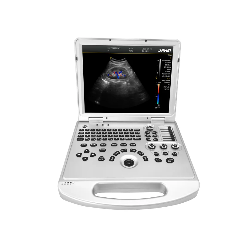 DAWEI Medical bedside color doppler ultrasound for POCUS