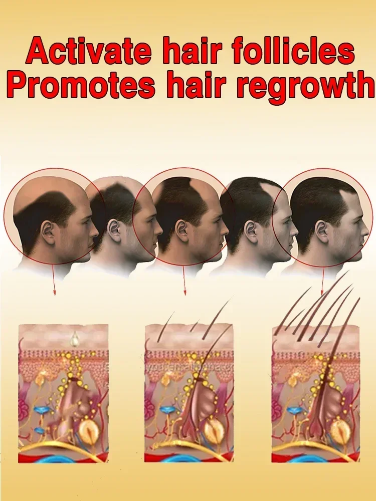 Minyak penumbuh rambut untuk pria, Serum kebotin cepat