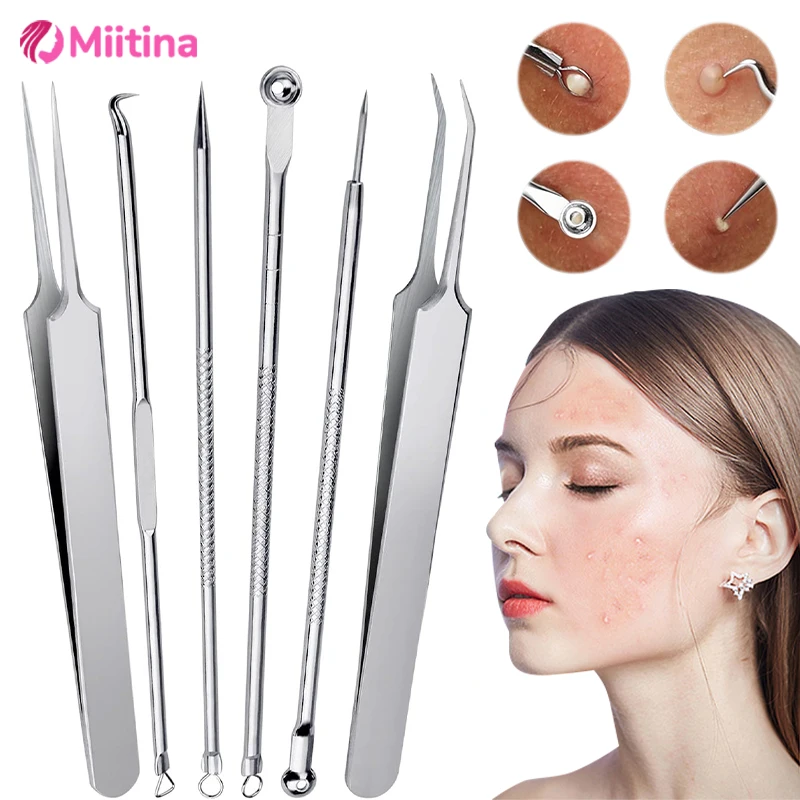 11 pçs/set acne cravo remoção agulhas conjunto de ferramentas beleza pinças conjunto remoção acne super apontado agulhas rosto cuidados com a pele ferramentas