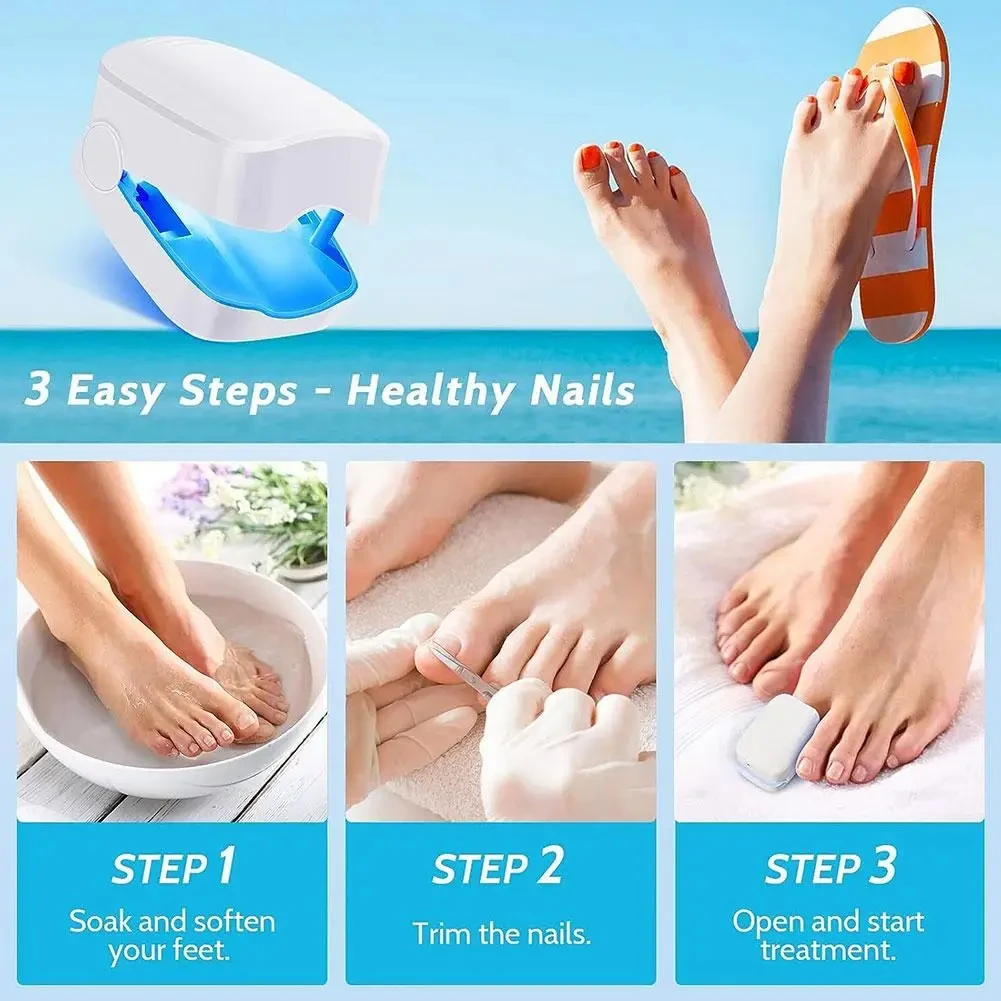 Nail Fungus Laser Treatment Device Repair Toenail Fingernail Effectively Remove Fungus Treat Onychomycosis Essential Oil