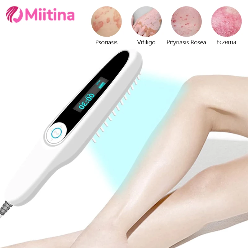 

УФ-лампа 311 нм, устройство для ультрафиолетовой терапии, красота, домашнее использование для ухода за кожей, чтобы компенсировать кожу, увлажненные лампы для фототерапии