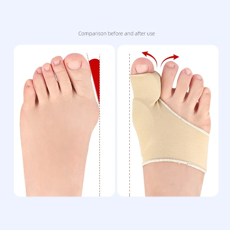 Forefoot Pad Enhanced Version Big Toe Bone Foot Guard Sebs Big Toe Guard Day And Night Big Toe Divider Hallux Valgus