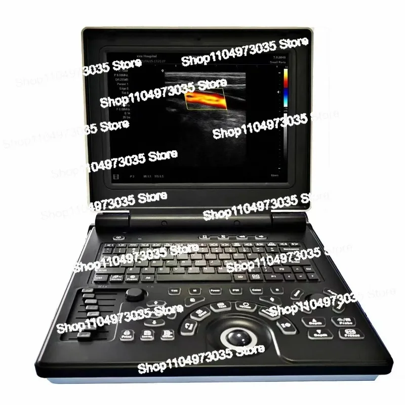 

3D Color Doppler Small Big Animal Veterinary Pet Notebook Ultrasound Diagnostic Echo Machine