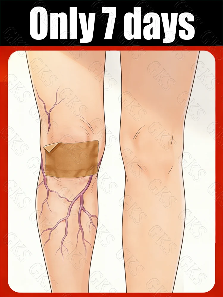 Soothing Leg Strain Relief Patches for Feet - Comfort And Relief for Tired And Aching Legs
