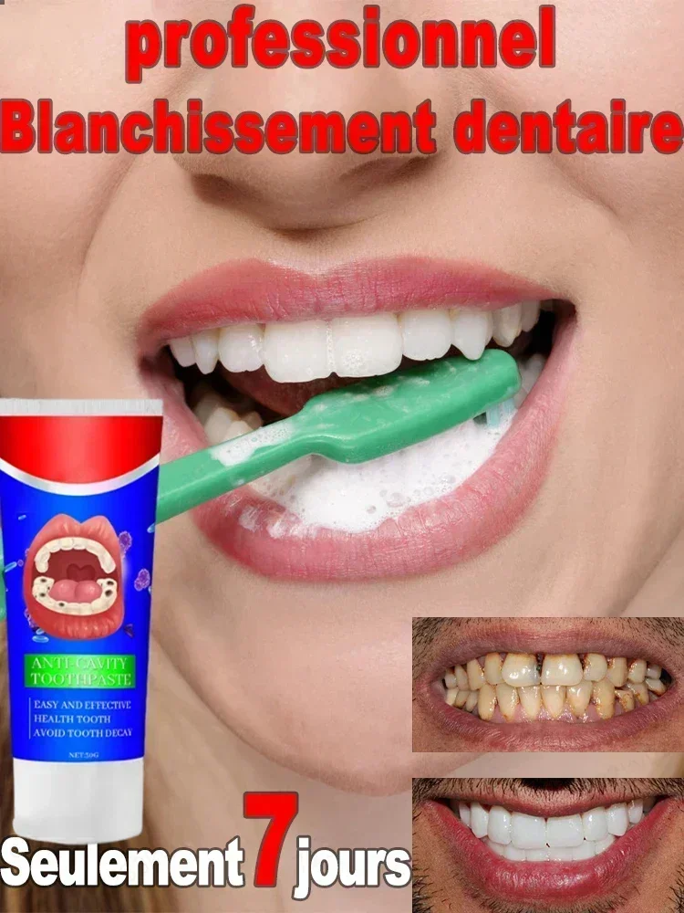 

Advanced Dental Care: Teeth whitening anti, Anti-Cavity, Fresh Breath, Plaque Removal, Toothache Relief, Periodontitis Repair