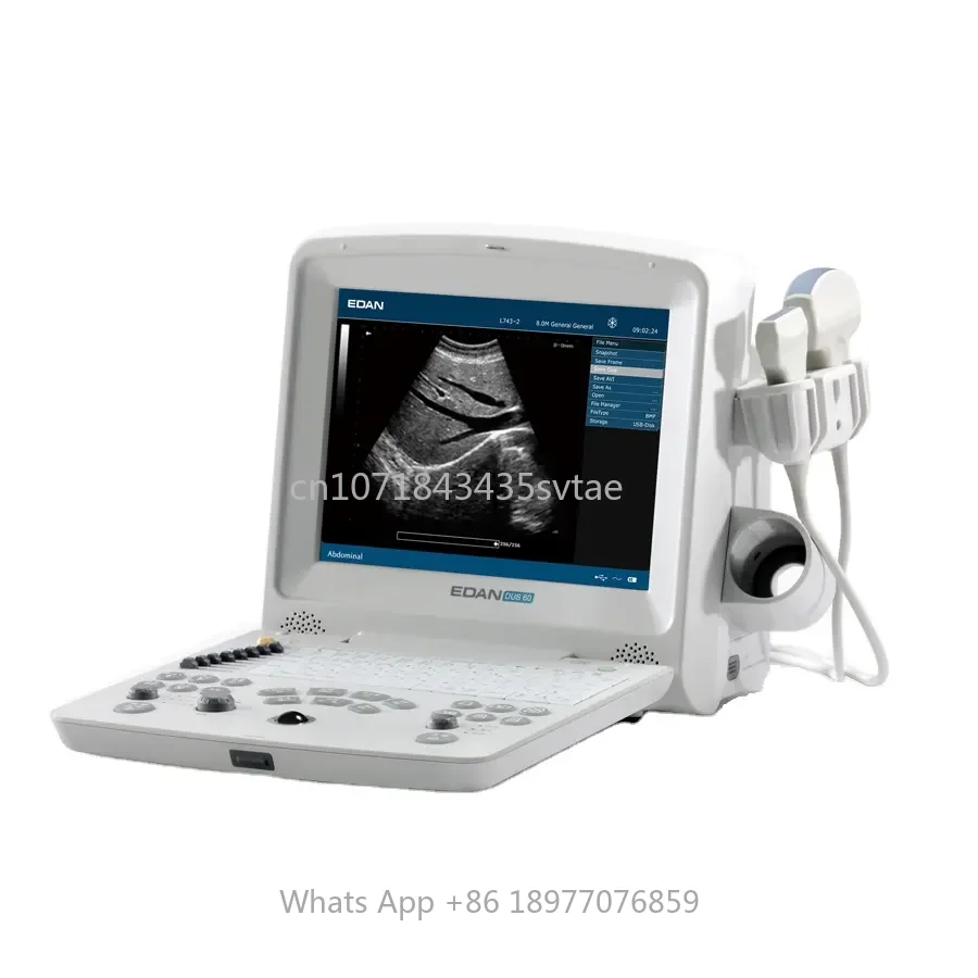 EDAN DUS60 Ultrasound Machine Bdomen Blood Vessels Muscles USG Machine Black And White