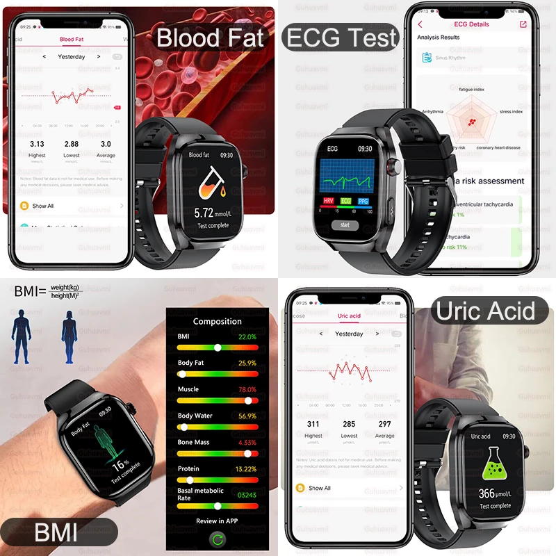 Smartwatch de saúde médica feminina, exame físico, gordura de açúcar no sangue, frequência cardíaca, ácido úrico, AMOLED Bluetooth Call, Smartwatch