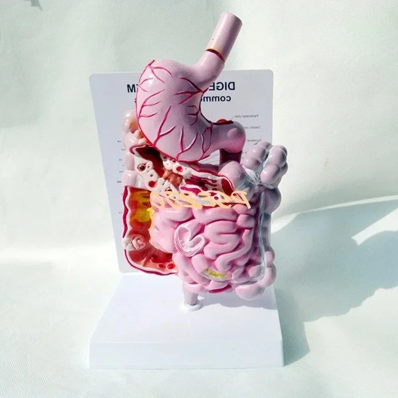 B-M Adult Human Digestive System Large Intestine Model Duodenal Visceral Gastrointestinal Medical Anatomical Model