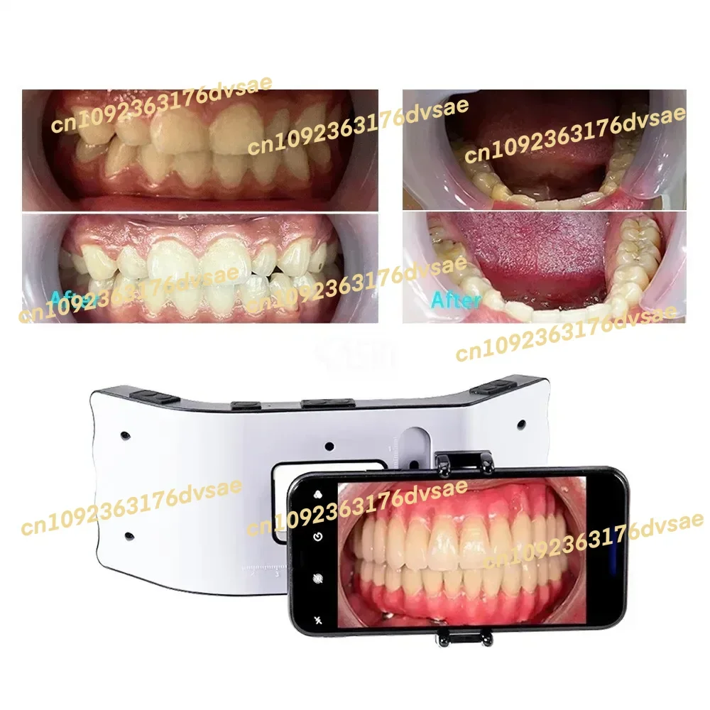 

2025 New Flash Light with Holder Photography Oral Filling Lamp Fotografia Orthodontics Equipment Light Environment Photo Lamp