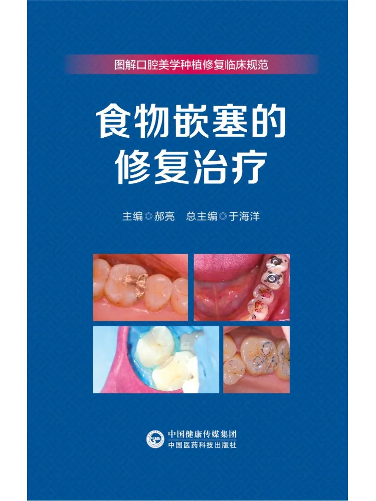 Book-Winshare Restorative Treatment For Food Impaction