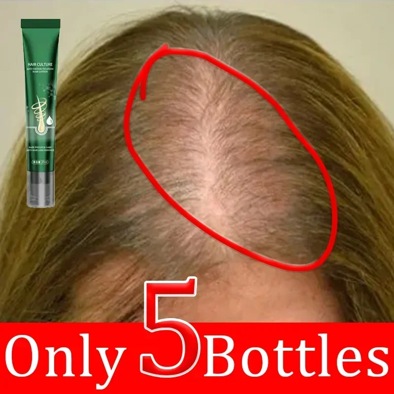 

Prevent Hair Loss Repair Hair Strong Hair Growth Spray Nourishes Roots Quickly Regenerates For Men Women Growth Spray