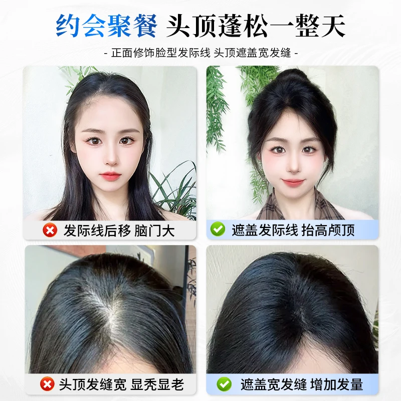 Pruik, vrouwelijk echt haar, heruitgave van top, verhoogd haarvolume, geen sporen, wit haar, pruik met hoge craniale toppony