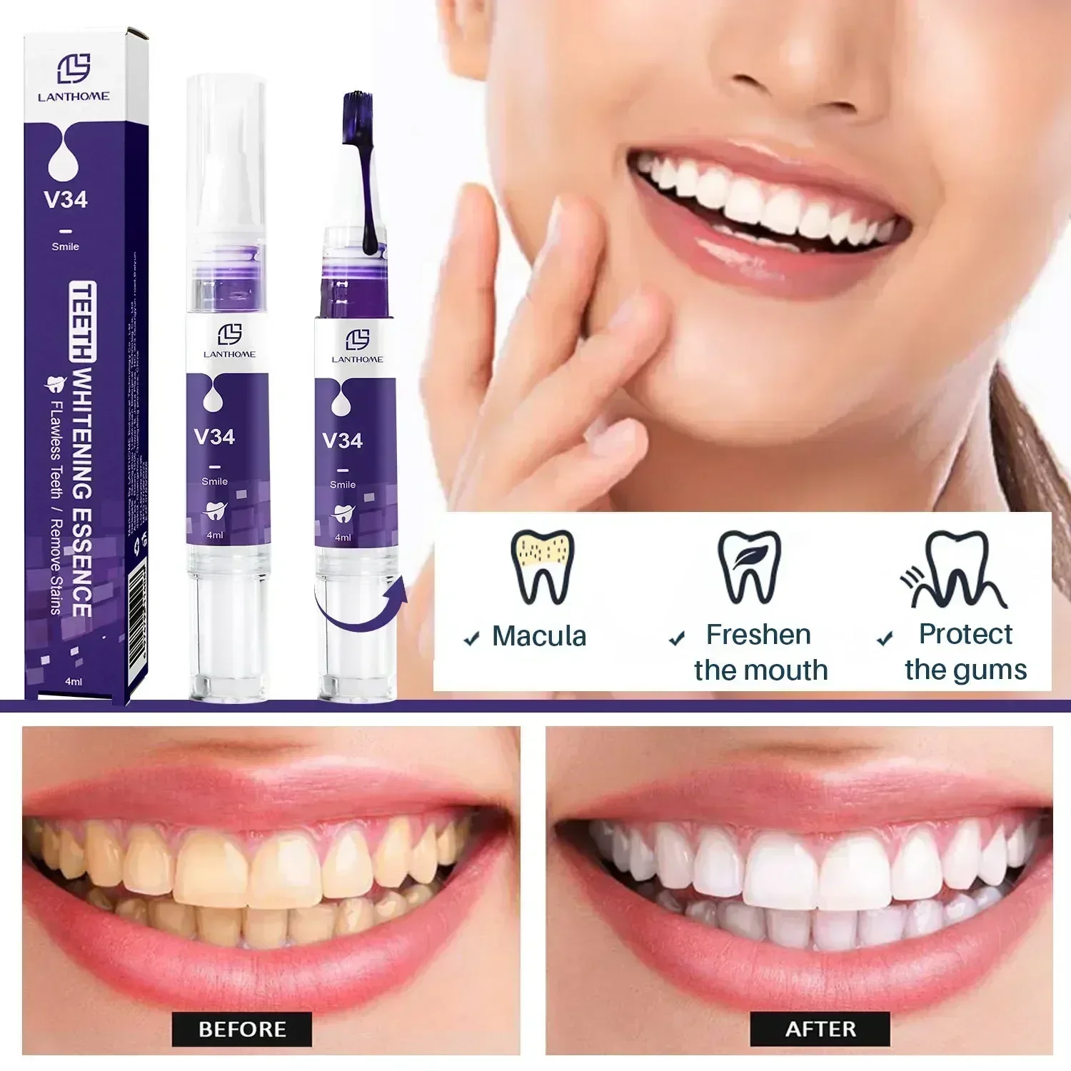 Dentes Whitening Creme Dental Pen, Iluminar Soro Limpo, Removedor de Manchas, Viagem Partable, Cor Roxa, V34