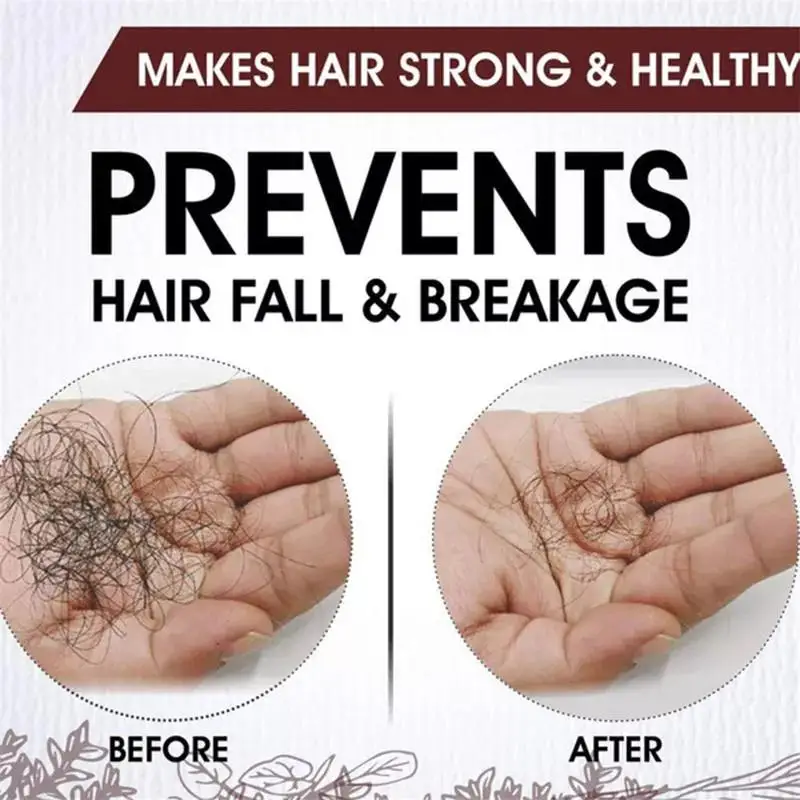 Rápido Grosso Natural Cabelo Crescimento Soro Óleo, Hair Care, Reconstrução do couro cabeludo, evitar a perda de cabelo, cabelo danificado Reparação