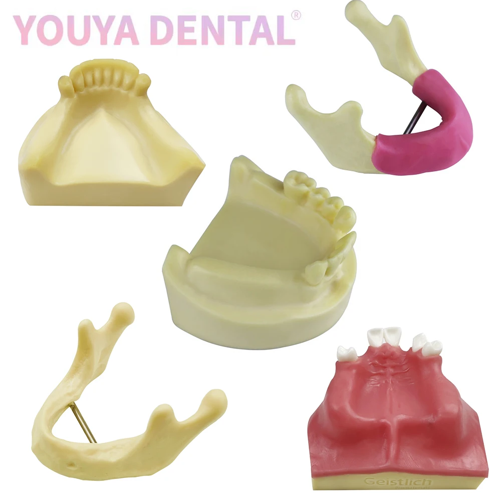 Dental Implant Practice Model Maxillary Mandibular Basic Implant Training Model With Soft Gums Suitable For Students To Practice