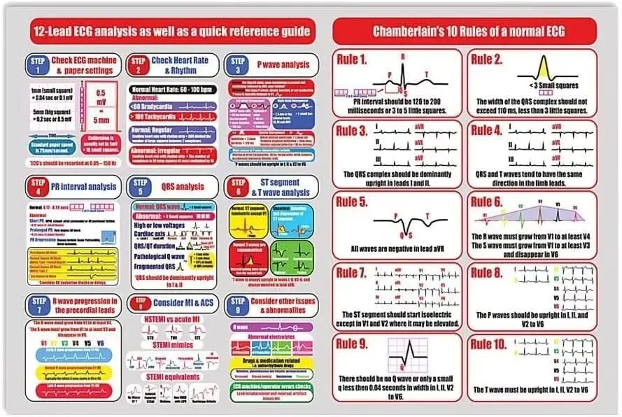 Analyse ECG connaissance signes métalliques analyse ECG Vintage12-Lead ainsi que un Guide de référence rapide impression d'affiches Chamberlain & # 3
