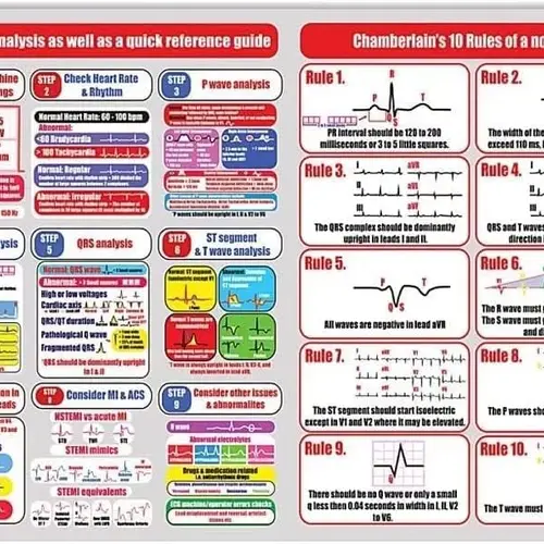 심전도 분석 지식 금속 신호 Vintage12-Lead 심전도 분석, 빠른 참조 가이드 포스터 인쇄 챔벌레인 & #3  Best5