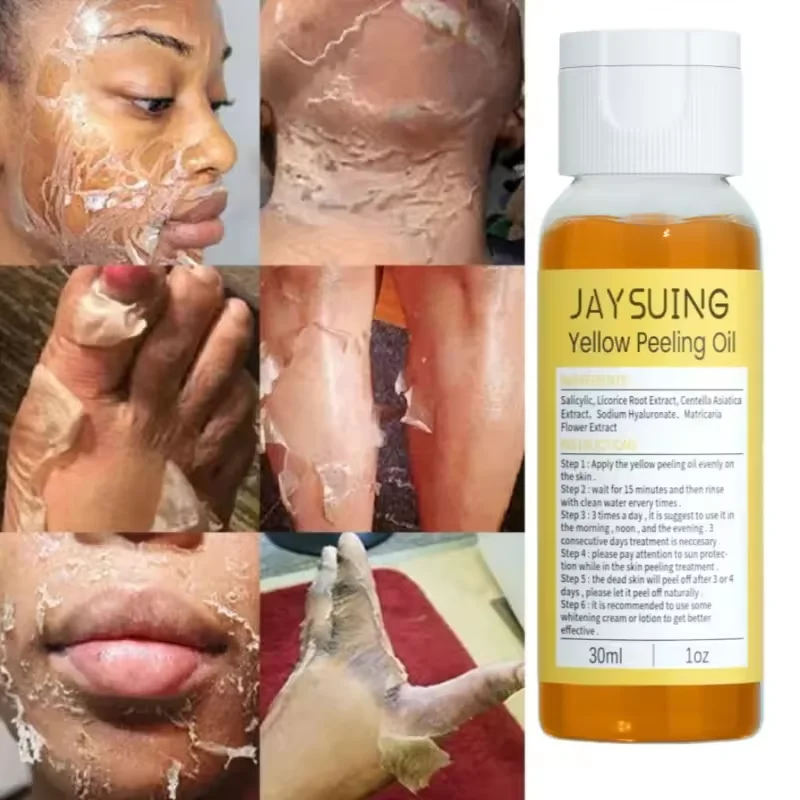 Yellow Peeling Oil 100% Organic Bleaching Dark Skin Exfoliating For Tender Glowing Skin Finger Joint Whitening Moisturizing Care