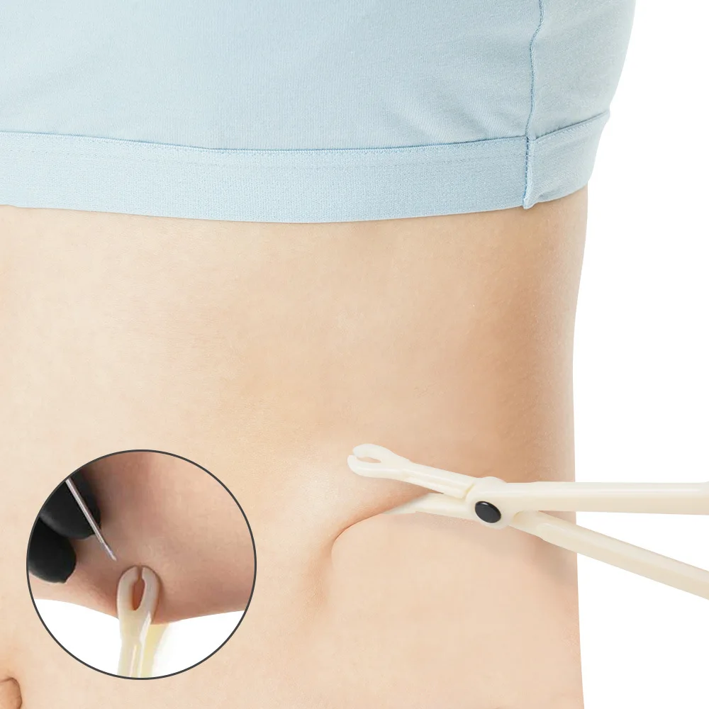 ملقط السرة المستدير المعقم ، المشبك ، كماشة مفتوحة مثلثة ، أدوات ثقب الأذن والأنف ، توريد الوشم ، 1 روض