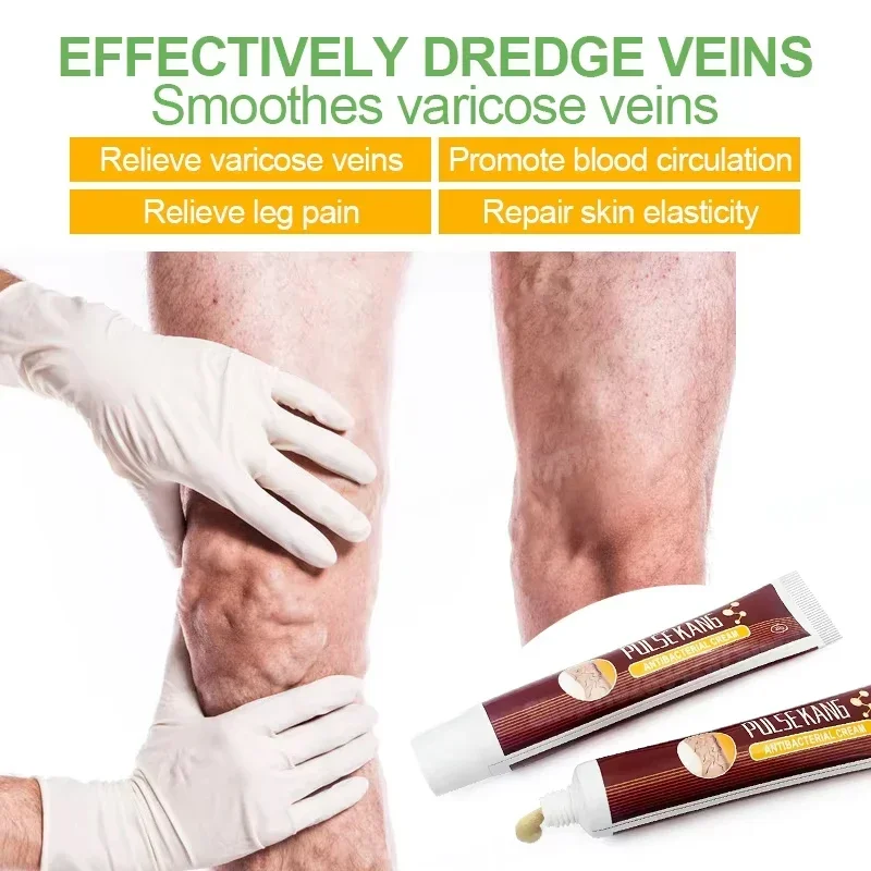 Varicose Vein Soothing Cream Gently Relieves Leg Discomfort Daily Massage Promotes Blood Circulation External Leg Care Cream