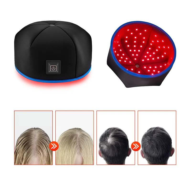 Hot Selling Near Infrared Red Light Therapy Hat Helmet Hair Regrowth Cap for Hair Growth Led Hair Cup