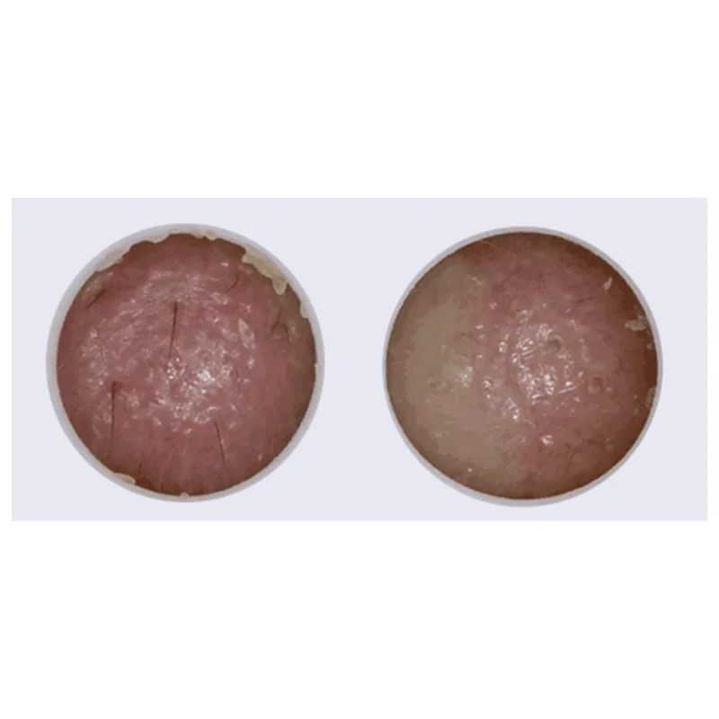 A78E-Visual Comedondrukker Facial Diepe Schone Machine Mee-eters En Acne Remover Verwarmd Gezicht Elektrische Mee-eter Sucker
