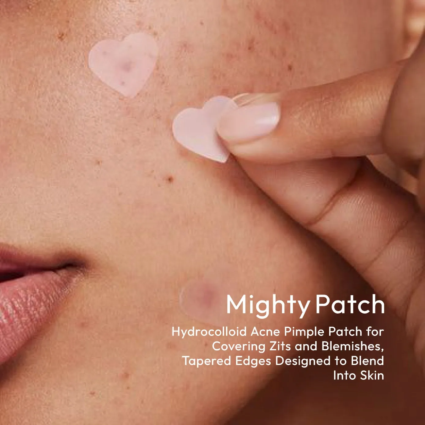 Plaster na trądzik w kształcie różowego serca - Zestaw sercowy z serii Pink: Delikatny i niepodrażniający, ukrywa wypryski, niedoskonałości i blizny po trądziku