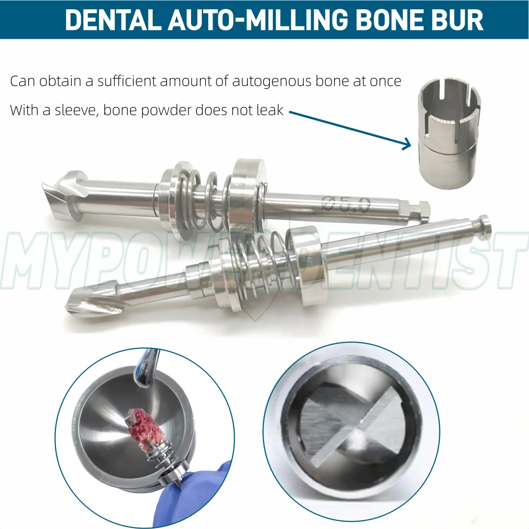 Dental Bonesier Autogeneous Bone Harvesting GBR Bone Collector Drill Spring Jeil