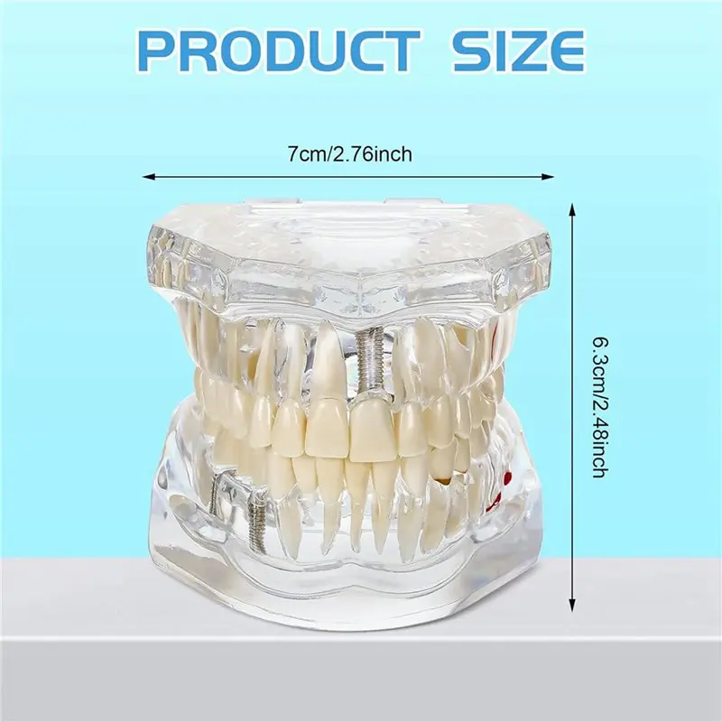 5X Disease Teeth Model Typodonts Implant Teeth Model With Removable Teeth Dentist Standard Tooth Demonstration