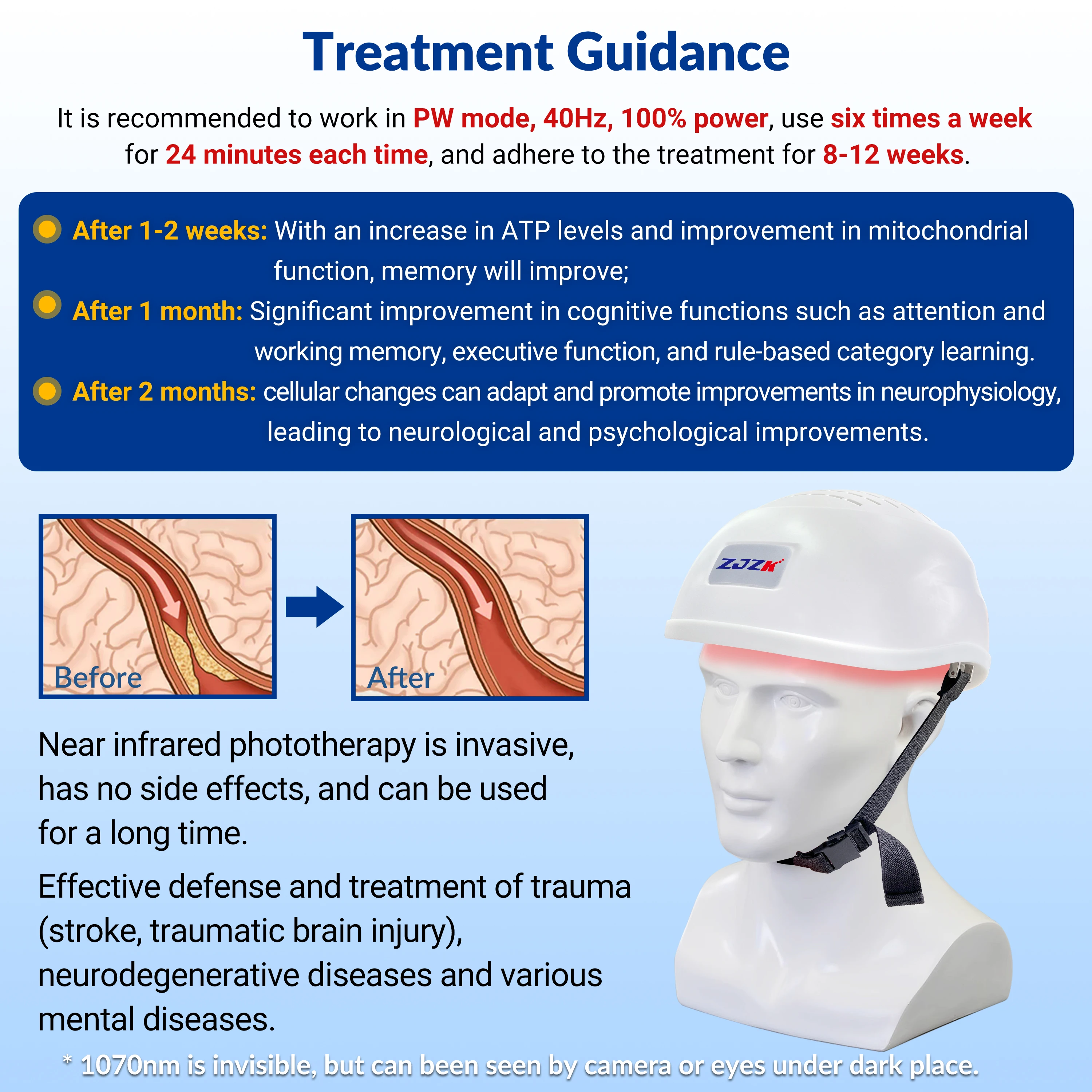 ZJZK Polio Autism Depression Laser Therapy Brain Injury Gifts 1070nmx280diodes Mental Disorders Post Traumatic Stress Disorder