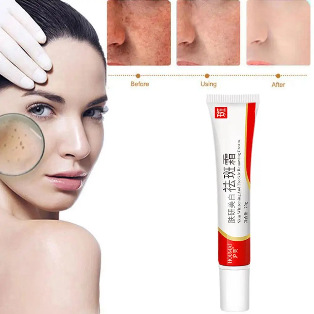 Crema blanqueadora para pecas, elimina manchas oscuras, antipecas, niacinamida, pigmentación, Melasma, ilumina el cuidado de la piel, 20g