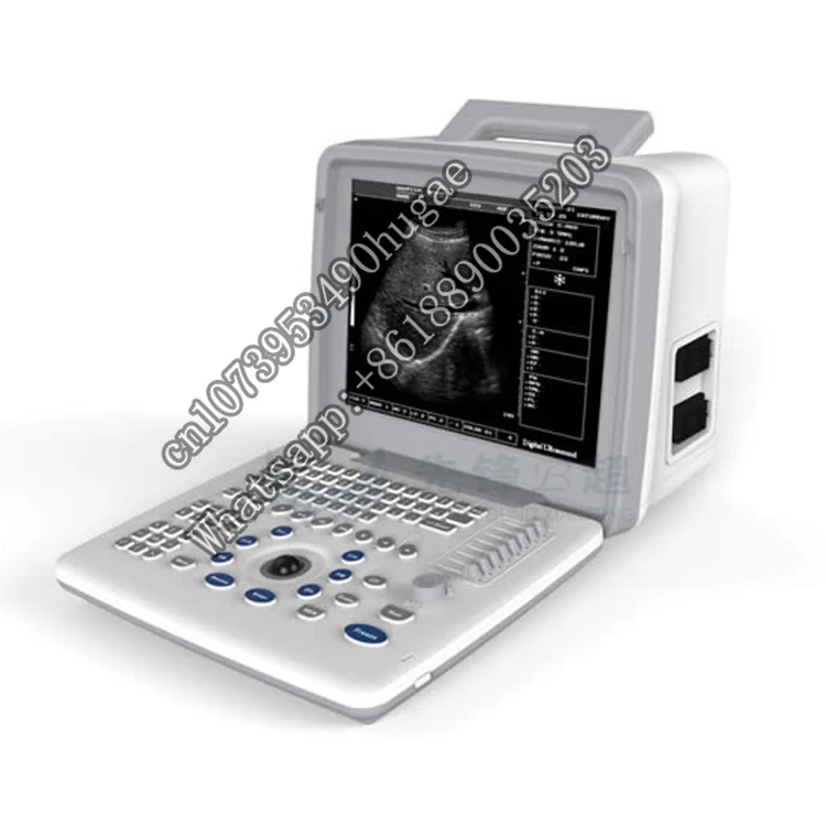 Various Good Quality XF300 VET Full Digital LED Livestock Portarable Hand Held Vet Ultrasound