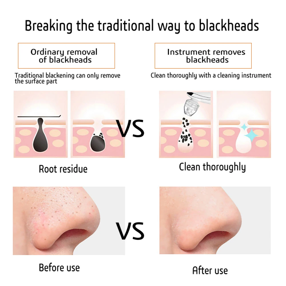 6 tryb ssania elektryczne urządzenie do usuwania zaskórników odkurzacz do usuwania trądziku usuwanie czarnych plam twarzy głębokie oczyszczanie urządzenie do oczyszczania porów