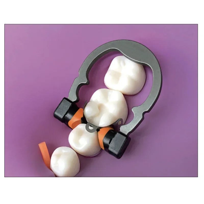 حلقة لقط زنبركية للأسنان من Niti R5 1.0 تيتانيوم صغير/أزرق متوسط/برتقالي مرونة جيدة أطراف نظرة خاطفة مواد تقويم الأسنان #3