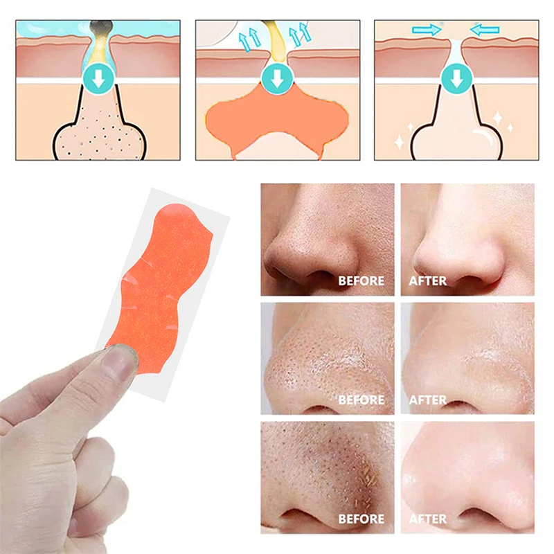 10/20/50 pz Rimozione di Comedone Striscia Nasale Acne Potente Adsorbimento Rimozione di Acari Pulizia Profonda Restringimento Liscio Maschera Per La Cura Della Pelle
